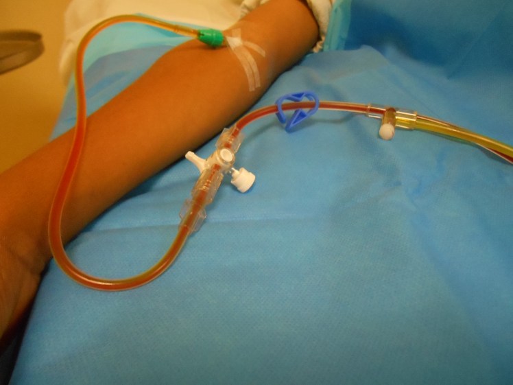 catheter-de-transfusion.jpg